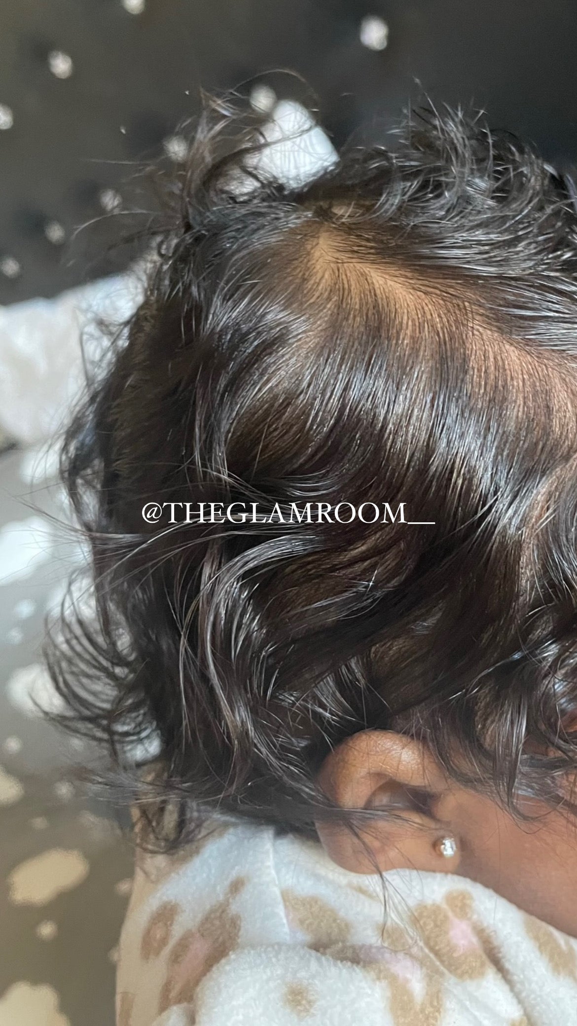 Baby Cradle Cap Kit